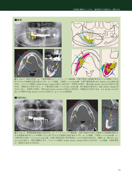 決定版 実践マニュアル 歯科用CTの見かた・読みかた 決定版 実践マニュアル 歯科用CTの見かた・読みかた | 森本 泰宏