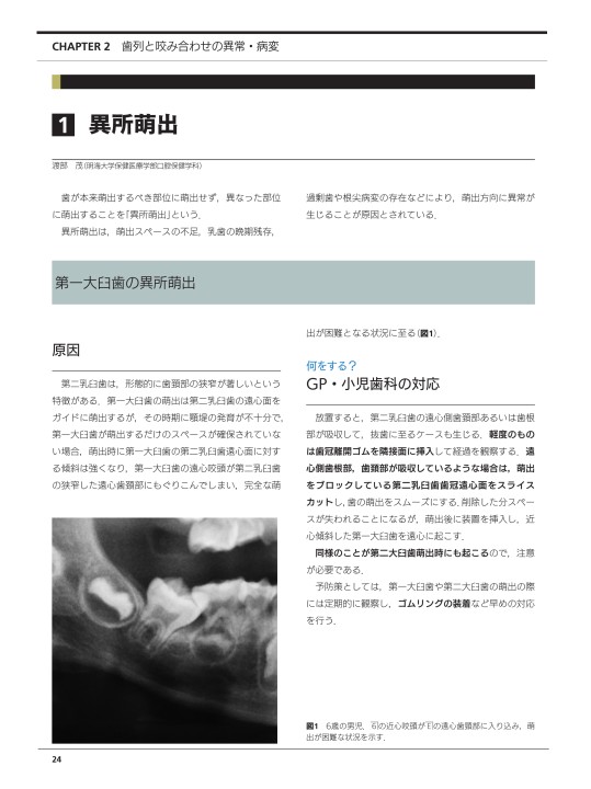 子ども口と顎の異常・病変 歯と顎骨編