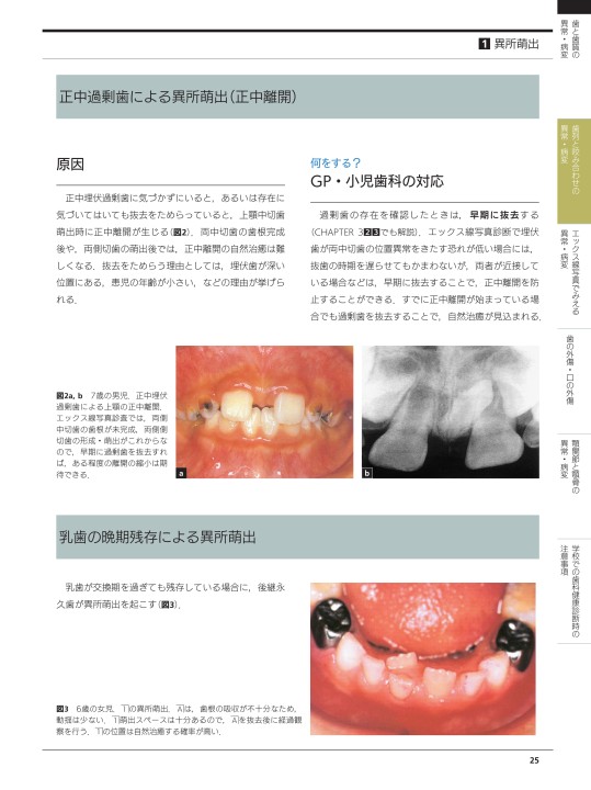子ども口と顎の異常・病変 歯と顎骨編