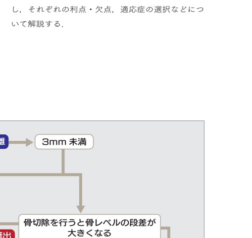 成功の方程式 図解！ 歯周外科を用いた歯肉縁下う蝕の治療手順