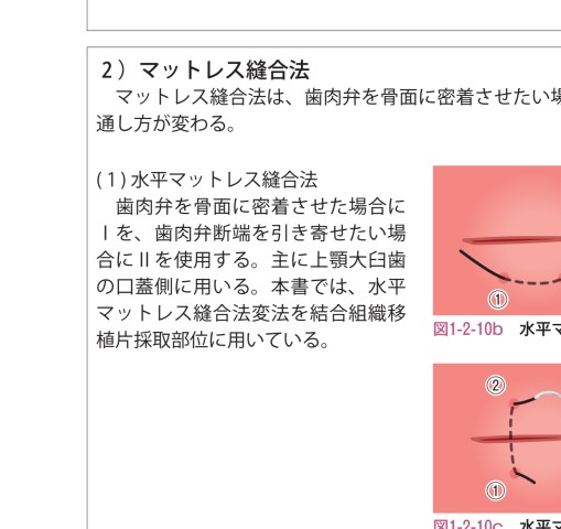 ブタ実習から学ぶ歯周外科サブノート