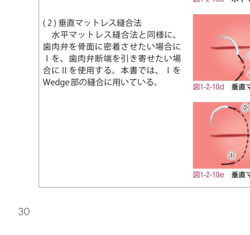 ブタ実習から学ぶ 歯周外科サブノート ブタ実習から学ぶ 歯周外科サブノート - クインテッセンス出版