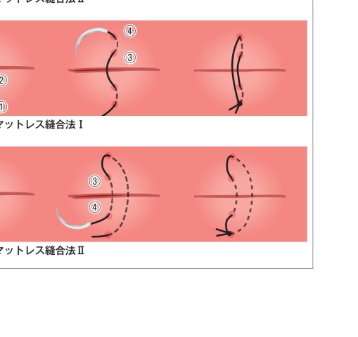 ブタ実習から学ぶ 歯周外科サブノート 91ezB4mGsKL.jpg