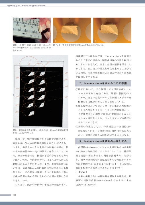 攻めのクラウン・ブリッジ S Shape Profileの臨床 行田克則・著 攻めのクラウン・ブリッジ S Shape Profileの臨床 行田克則・著