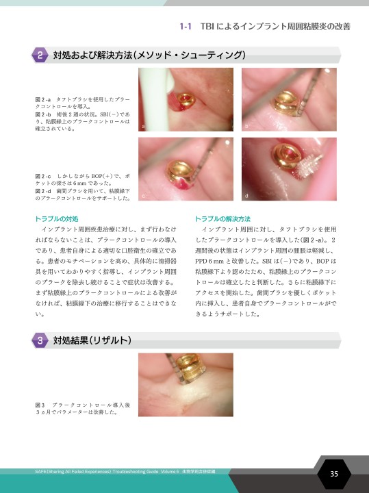 SAFE Troubleshooting Guide Volume 6 生物学的合併症編