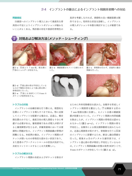 SAFE Troubleshooting Guide 1 機械・構造的合併症編 SAFE Troubleshooting Guide Volume 6 生物学的合併症編