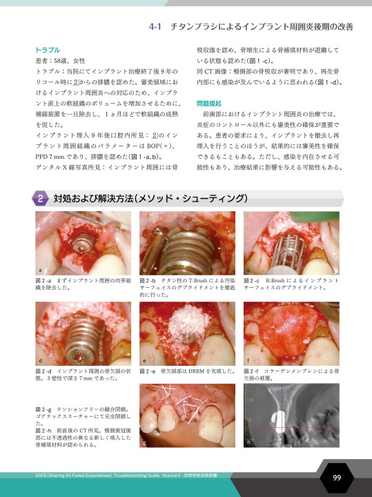 SAFE Troubleshooting Guide Volume 6 生物学的合併症編
