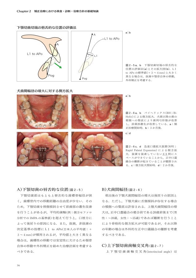 矯正歯科治療の基本と類似症例が必ず見つかる！ラーニングステージ別 