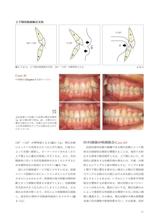 矯正歯科治療の基本と類似症例が必ず見つかる！ラーニングステージ別