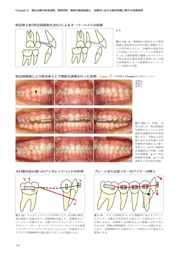 矯正歯科治療の基本と類似症例が必ず見つかる！ラーニングステージ別