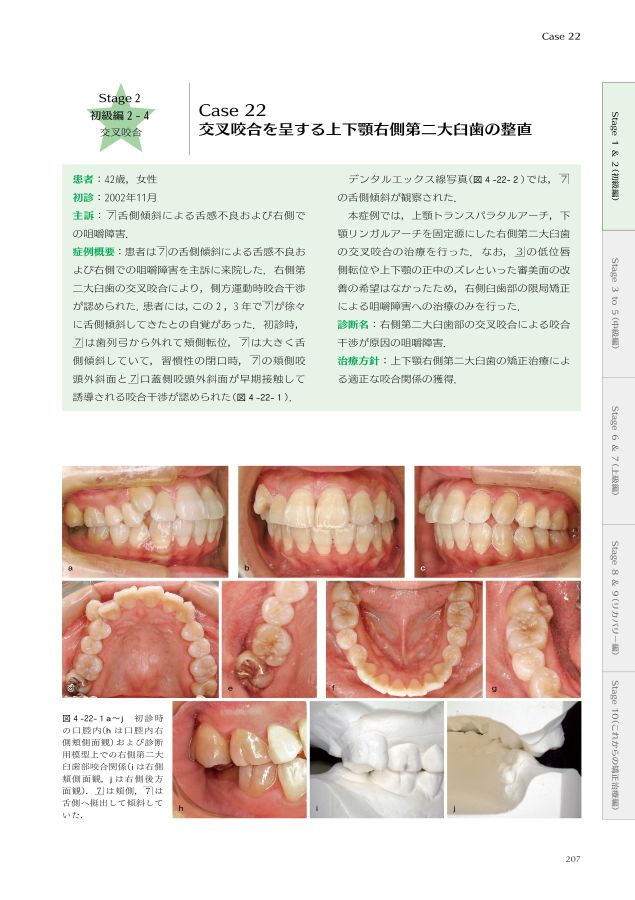 ⚠️裁断済　矯正歯科治療の基本と類似症例が必ず見つかる!ラーニングステージ別臨床例 矯正歯科治療の基本と類似症例が必ず見つかる!ラーニングステージ別
