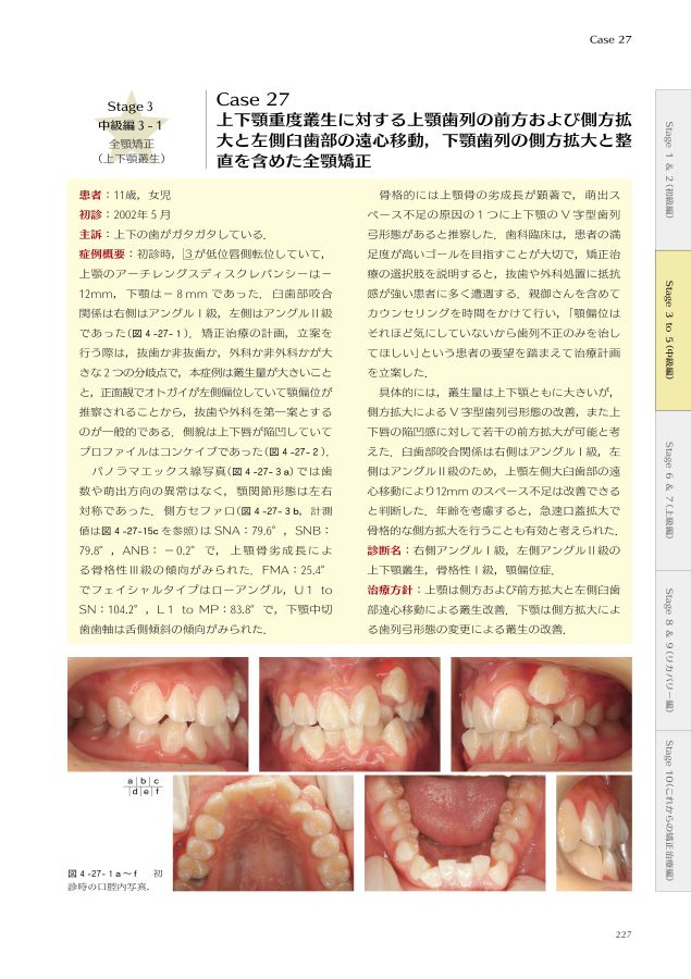 矯正歯科治療の基本と類似症例が必ず見つかる!ラーニング 矯正歯科治療の基本と類似症例が必ず見つかる!ラーニング