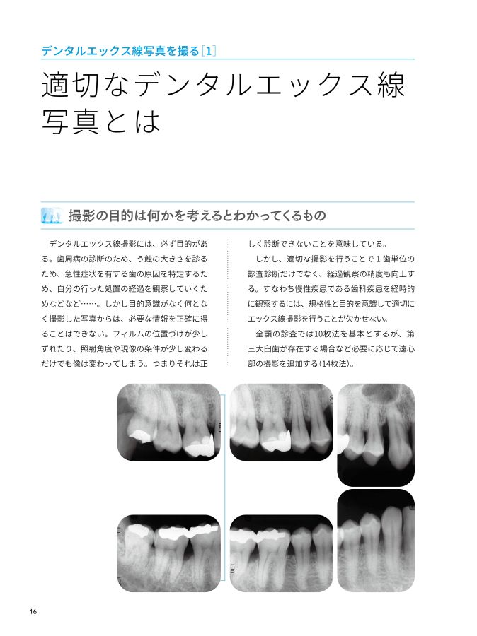 デンタルエックス線写真 DENTAL-X