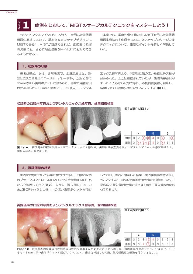 イラスト・写真・動画で学ぶ！ 低侵襲 歯周組織再生療法