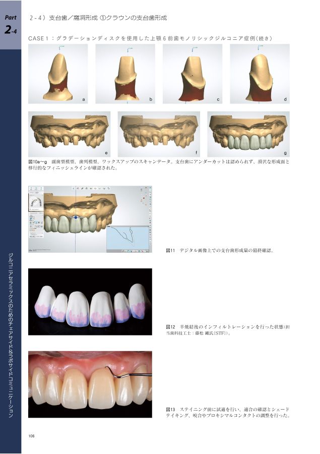 歯科医師・歯科技工士のための 最新ジルコニア修復