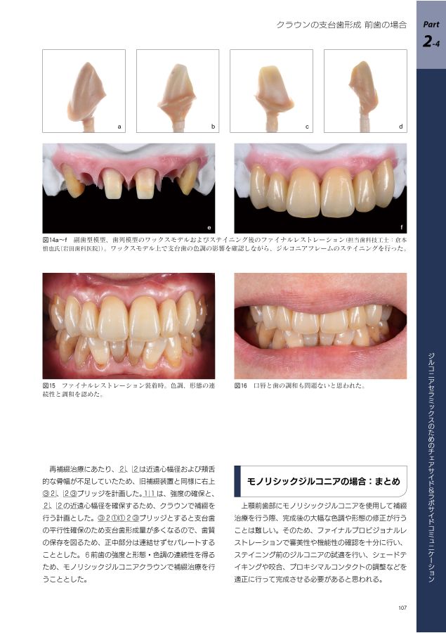 歯科医師・歯科技工士のための 最新ジルコニア修復