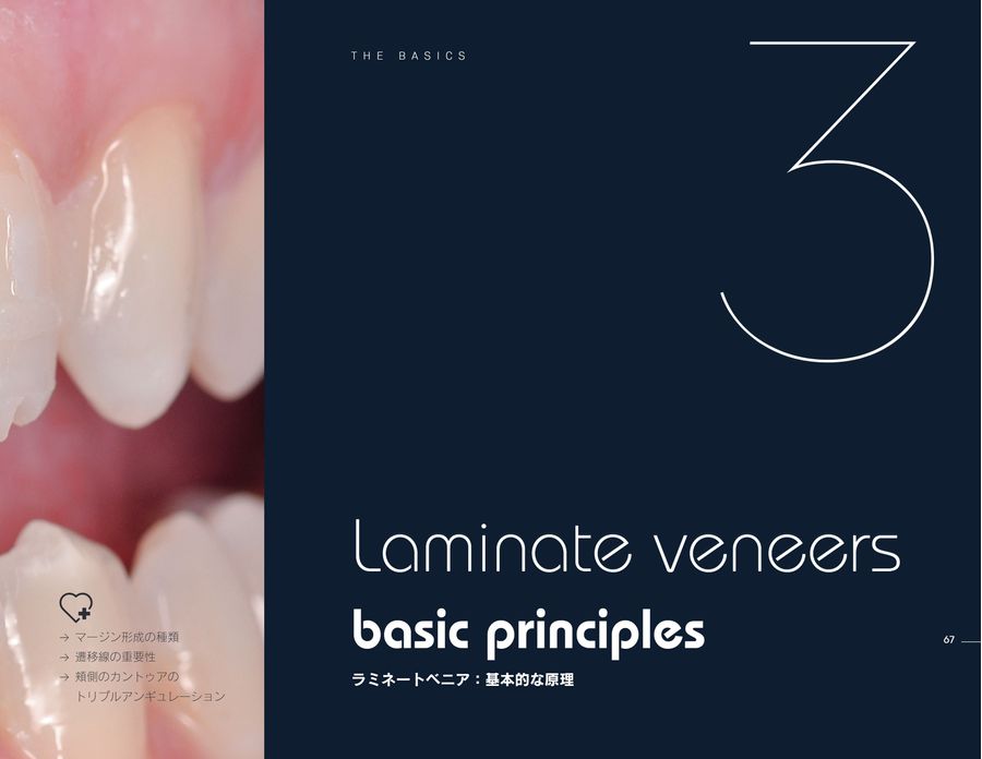 ラミネートベニア スマイルデザインのレシピ20