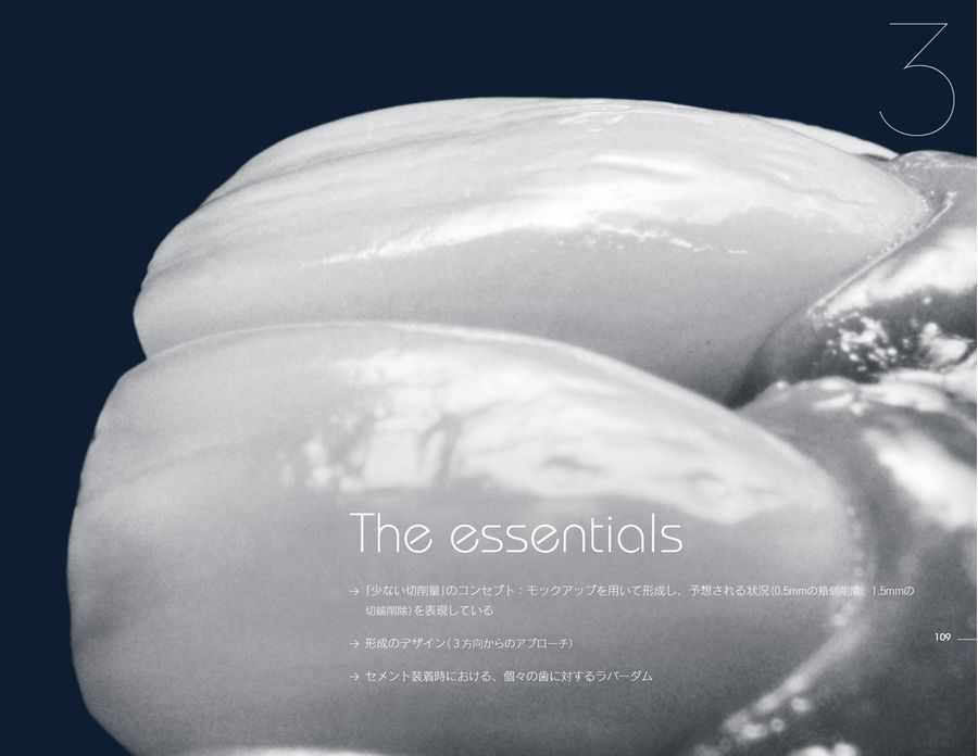 ラミネートベニア スマイルデザインのレシピ20