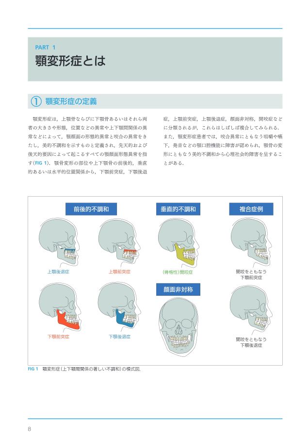 顎変形症治療の基礎知識