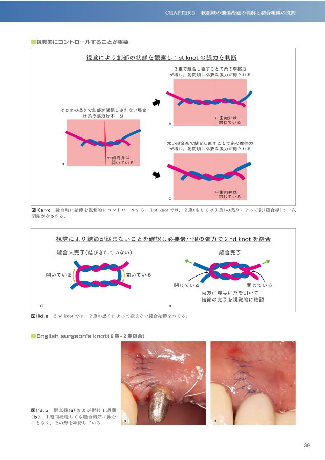 歯周・インプラント治療における再生療法 歯周・インプラント治療における再生療法（歯周・インプラント