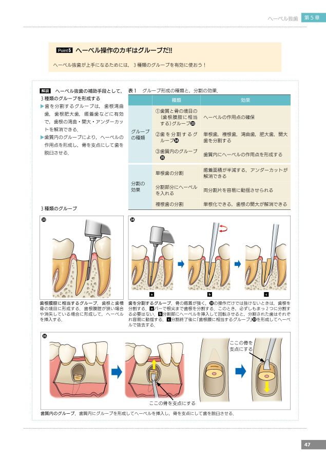 必ず上達抜歯手技_増補新版_link
