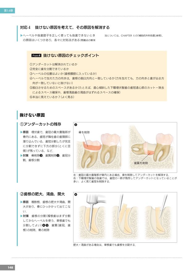 必ず上達 抜歯手技 増補新版 裁断済み 必ず上達 抜歯手技 増補新版 裁断済み 必ず上達 抜歯手技