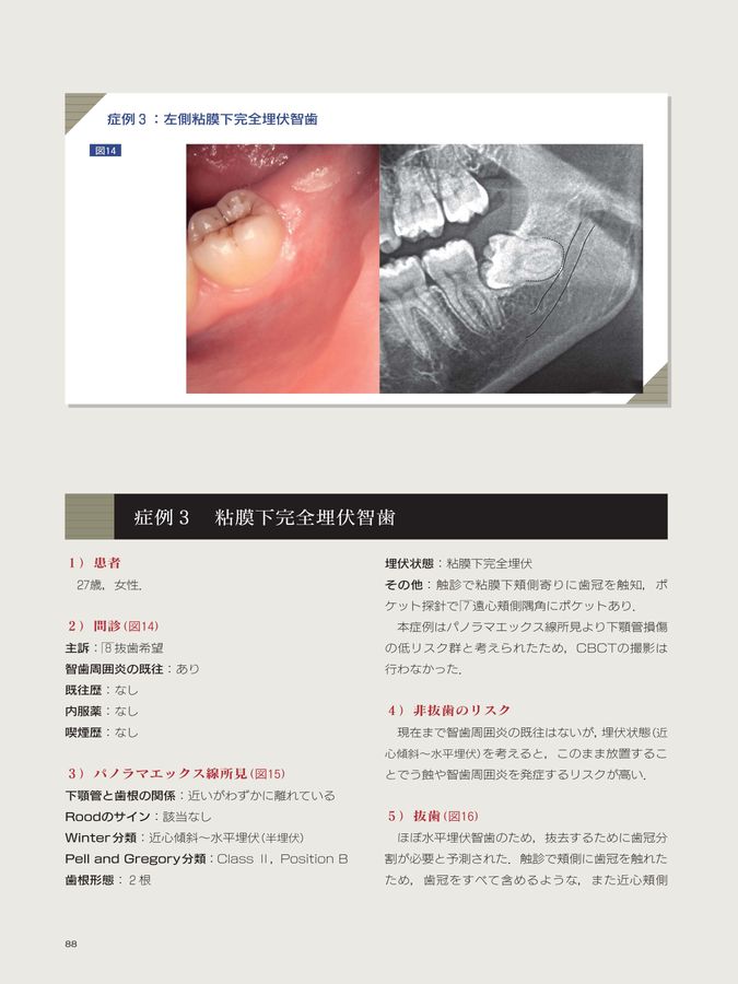 科学的根拠に基づいたビジュアル下顎埋伏智歯抜歯 科学的根拠に基づいたビジュアル下顎埋伏智歯抜歯
