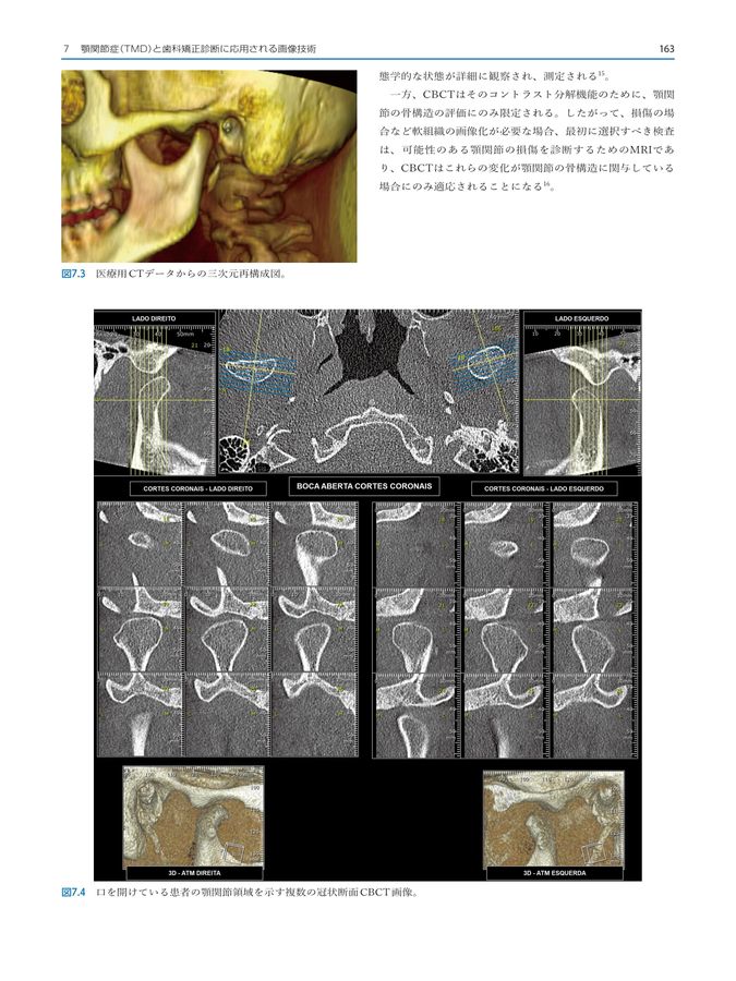 歯科矯正学における3D診断および治療計画