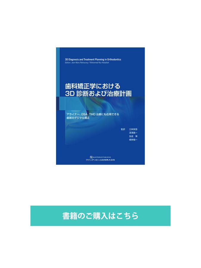 歯科矯正学における3D診断および治療計画