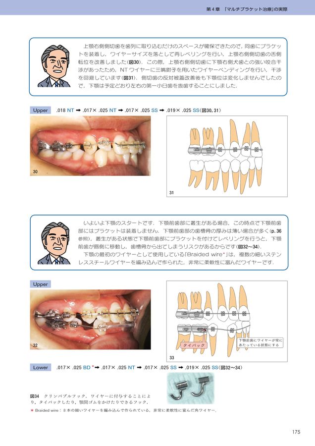 【裁断済み】図解!矯正治療が面白いほどわかる本 Amazon.co.jp: 図解! 矯正治療が面白いほどわかる本: 基礎知識
