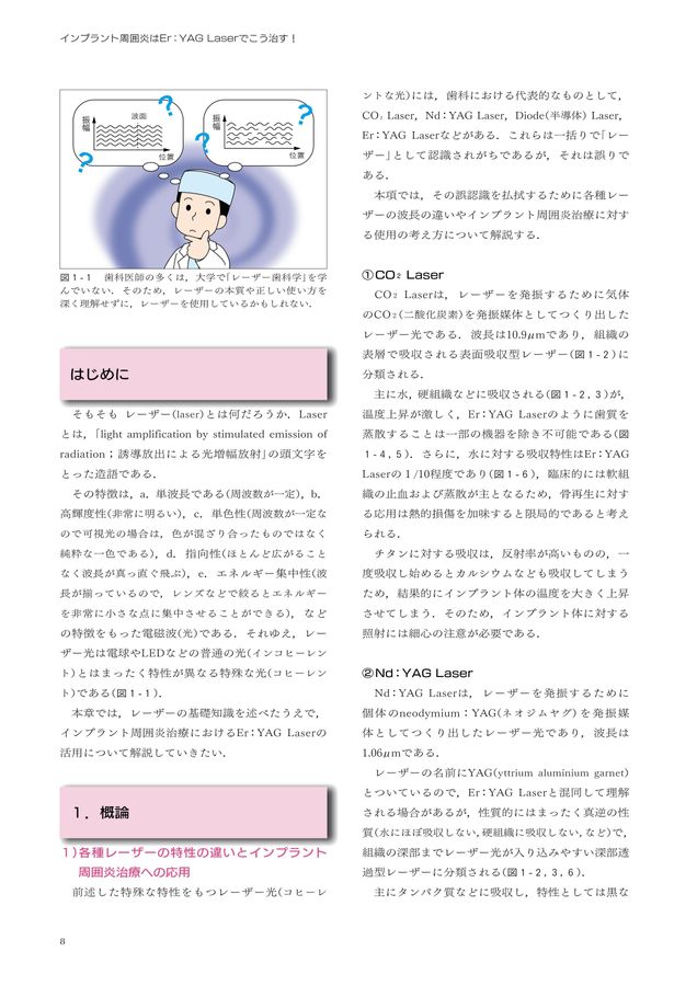 インプラント周囲炎はErYAG Laserでこう治す！