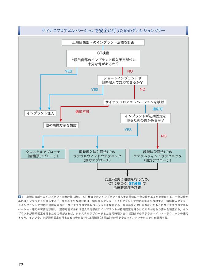 【裁断済】【即日発送】サイナスフロアエレベーションアルティメットガイド 裁断済】【即日発送】サイナスフロアエレベーション