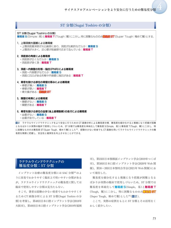 サイナスフロアエレベーションアルティメットガイド