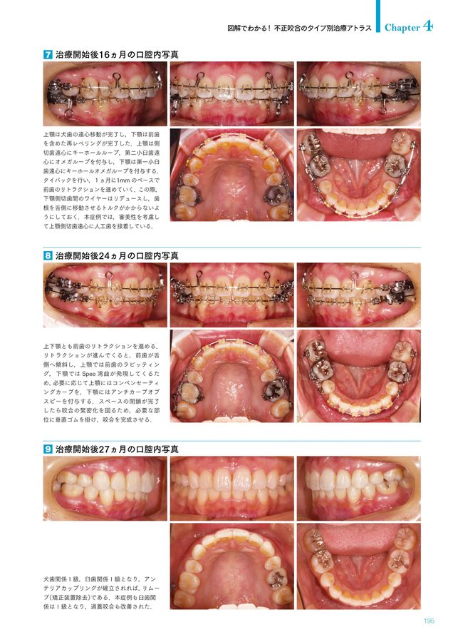 裁断済み　GPのための矯正歯科臨床ガイドブック GPのための矯正歯科臨床ガイドブック: 成人矯正歯科臨床から学ぶ