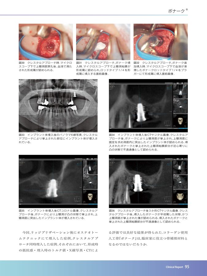 TQ別冊骨補填材料＆メンブレンYB2023／2024