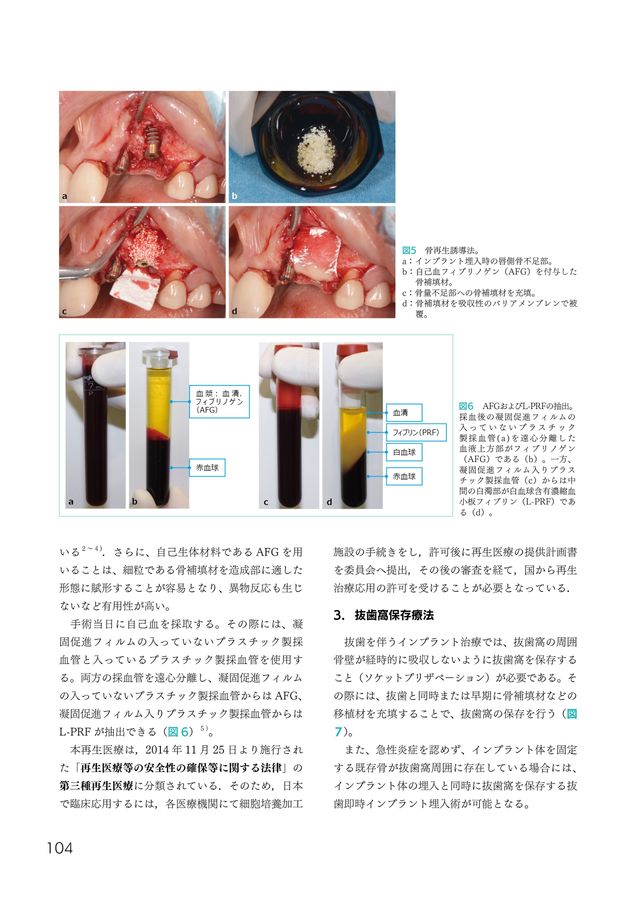 インプラントの専門医を取得するための研修マニュアル インプラントの専門医を取得するための研修マニュアル | 公益