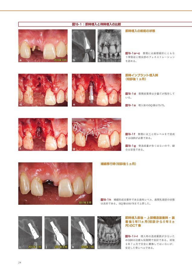 即時治療の真髄