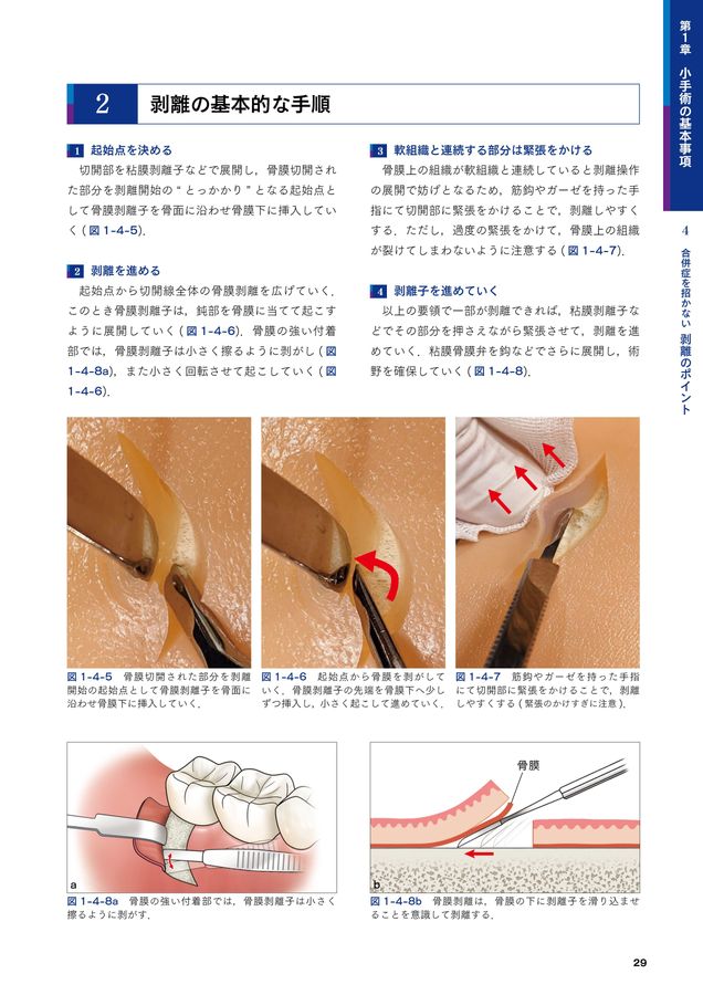必ず上達歯科小手術