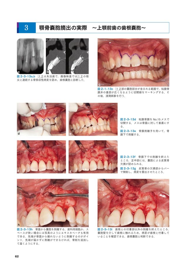 必ず上達歯科小手術