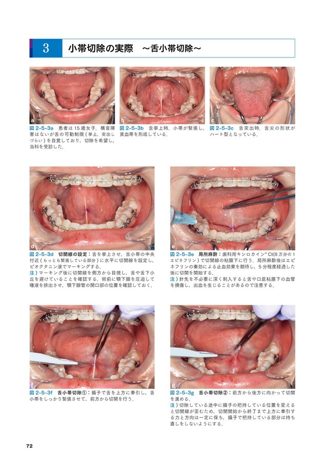必ず上達歯科小手術