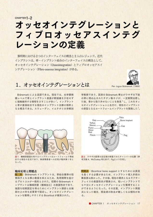 インプラント図鑑 インプラント図鑑