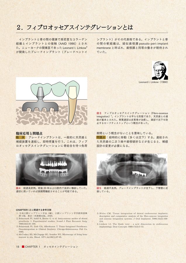 インプラント図鑑 インプラント図鑑