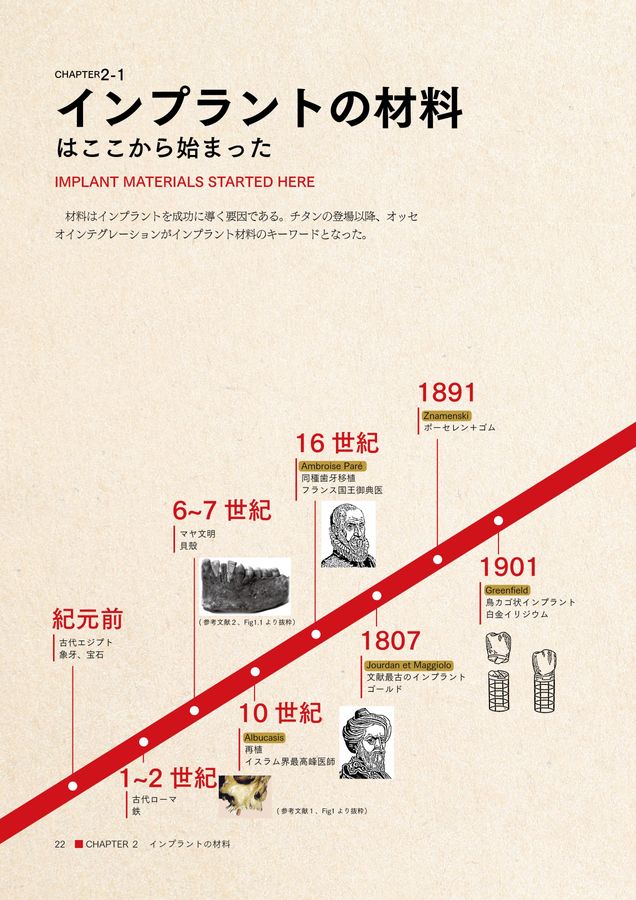 インプラント図鑑