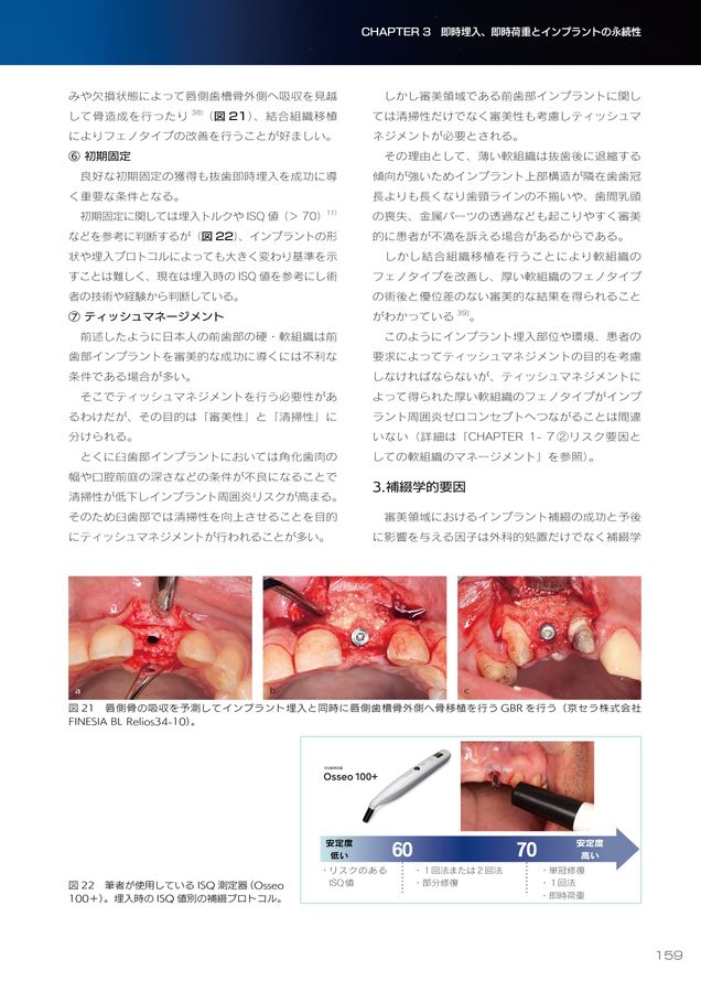 インプラント周囲炎ゼロコンセプト