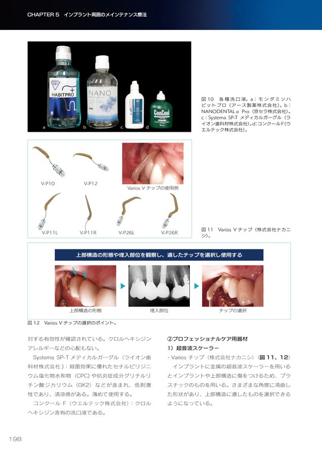 【裁断済み】インプラント周囲炎ゼロコンセプト 裁断済み】インプラント周囲炎ゼロコンセプト - メルカリ