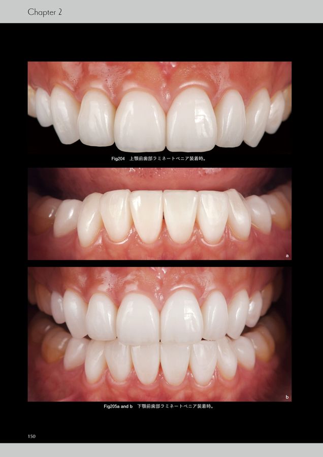 【裁断済】 イノベーション・オブ・ラミネートベニア 20年の臨床と研究が示す価値 イノベーション・オブ・ラミネートベニア: 20年の臨床と研究が