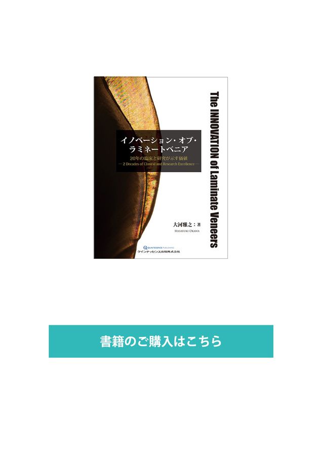 イノベーション・オブ・ラミネートベニア