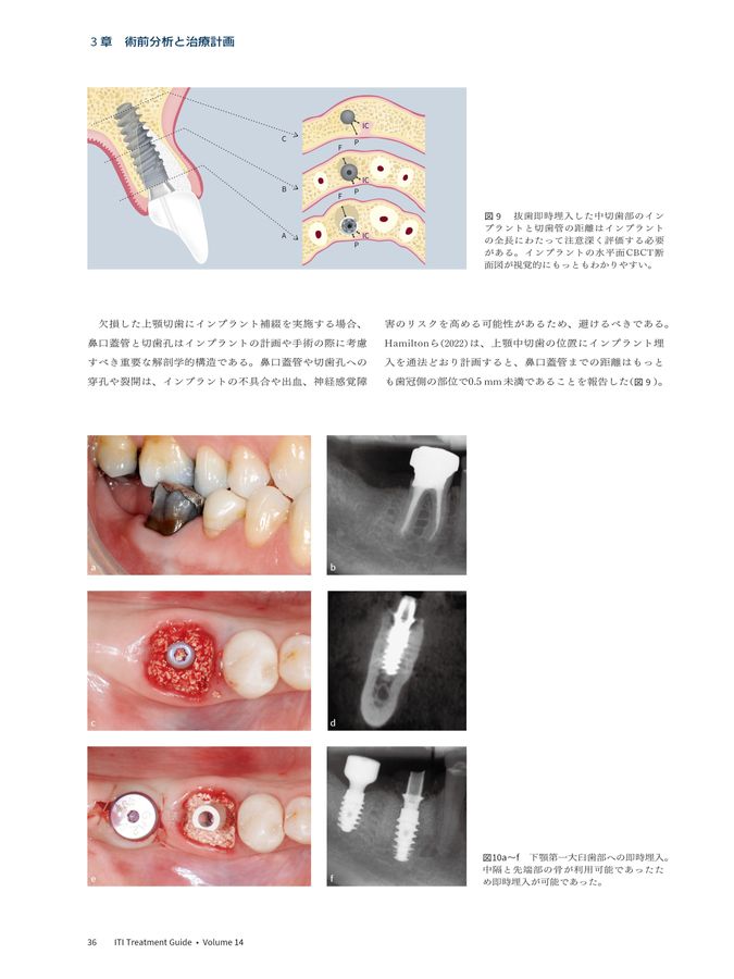 x1.jpg?c=20240828155307