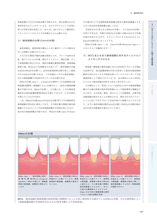 非う蝕性歯頸部歯質欠損 NCCL