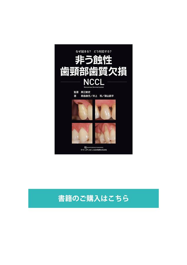非う蝕性歯頸部歯質欠損 NCCL